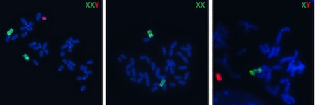 Figura trapianto di cromosoma1